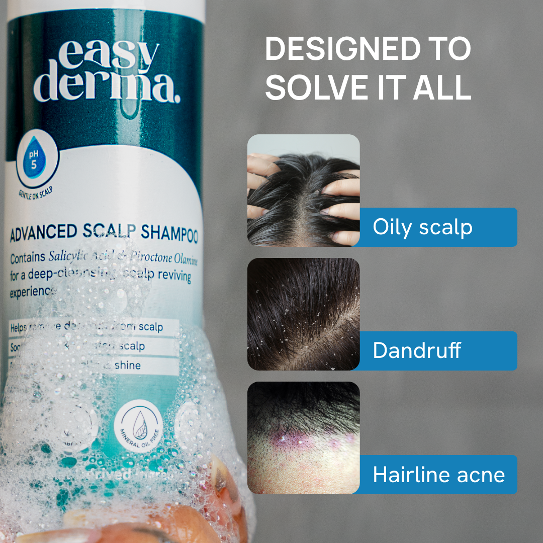 Advanced Scalp Shampoo - Anti Dandruff & Anti Fungal Shampoo
