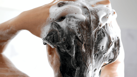 Ketomac Shampoo Alternative: Gentle Solutions for Dandruff & Scalp Care