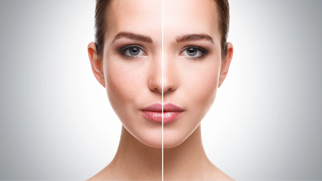 Acne Soap Bar: Your Daily Defence Against Breakouts