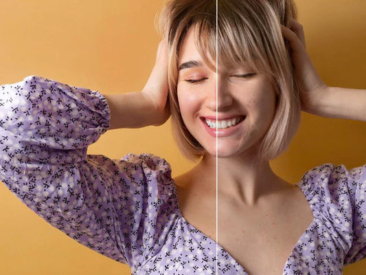 5 Dermatologist Recommended Tips to Cure Acne Breakouts.