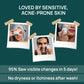 Acne Support Bar - Inhibits Bacterial Growth, Controls Acne & Hydrates Your Skin