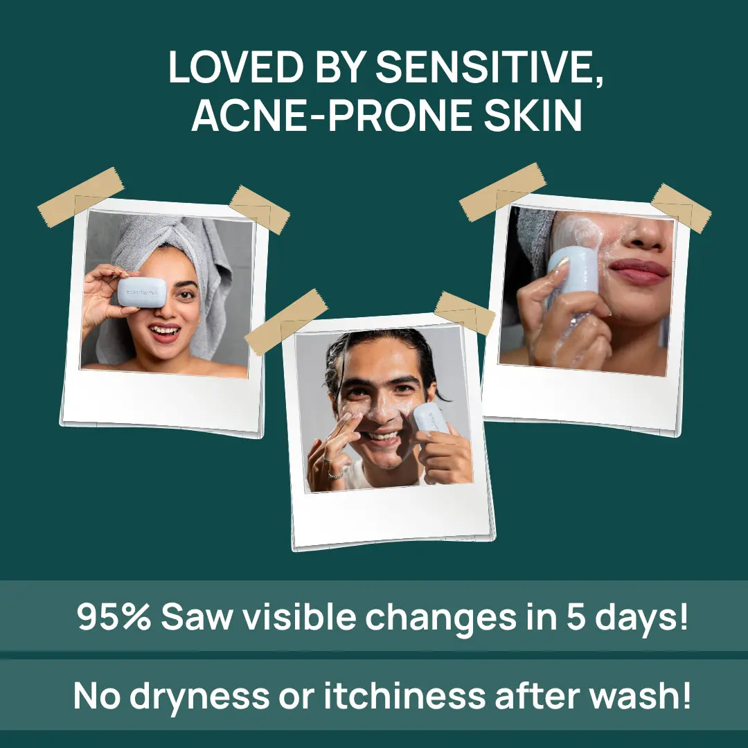 Acne Support Bar - Inhibits Bacterial Growth, Controls Acne & Hydrates Your Skin